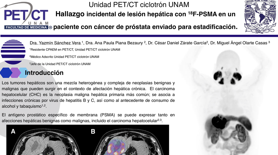 CARTEL PSMA.png