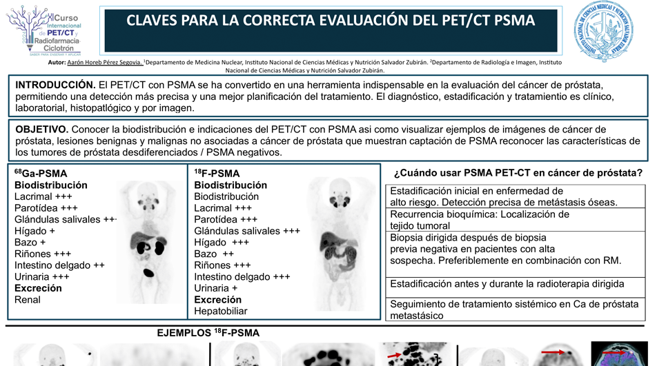 Cuándo usar PSMA PET.png