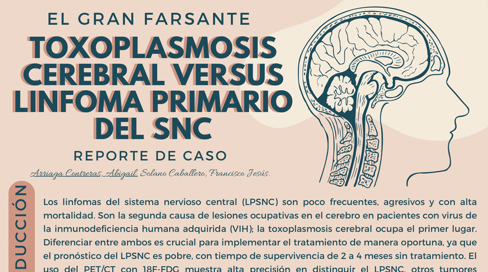 El gran farsante toxoplasmosis cerebral versus linfoma primario del sistema nervioso central. Reporte de caso..png