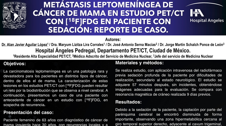 METÁSTASIS LEPTOMENÍNGEA DE CÁNCER DE MAMA EN ESTUDIO PETCT CON 18FFDG EN PACIENTE CON SEDACIÓN REPORTE DE CASO.png