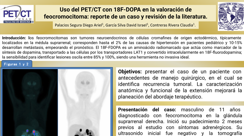 cartel feocromocitoma unam.png