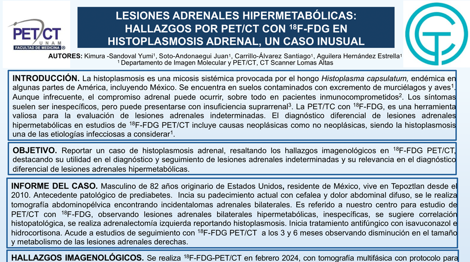 Cartel histoplamosis adrenal .png