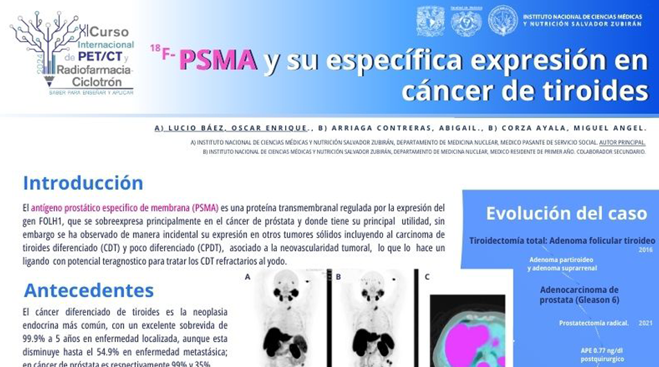 Cartel PSMA y su específica expresión en cáncer de tiroides.jpg